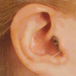 Aud&iacute;fonos CIC Digitales