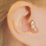 Aud&iacute;fonos Retroauriculares 